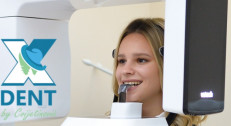 4200 din za digitalno 3D snimanje zuba u ordinaciji X DENT!