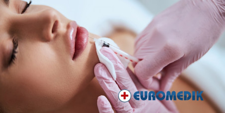 12000 din za tretman osveženja usana hijaluron filerima (0,5ml Juvederm Volift) u Euromediku na Slaviji!